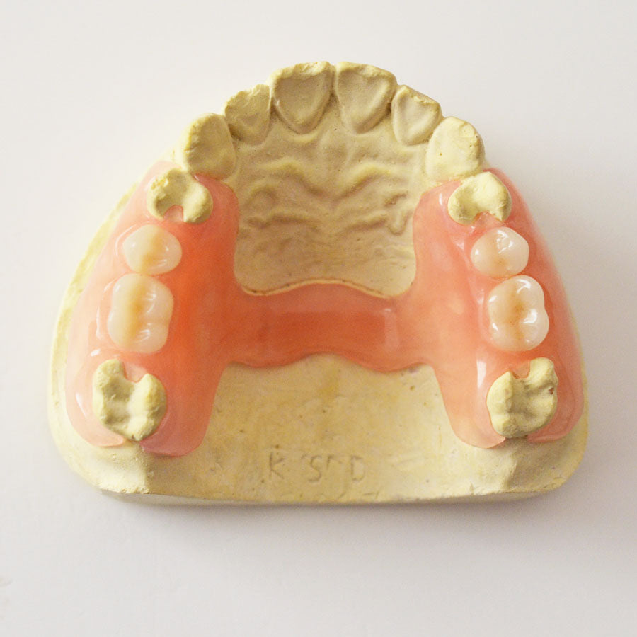 Custom Flexible Valplast Partial Denture