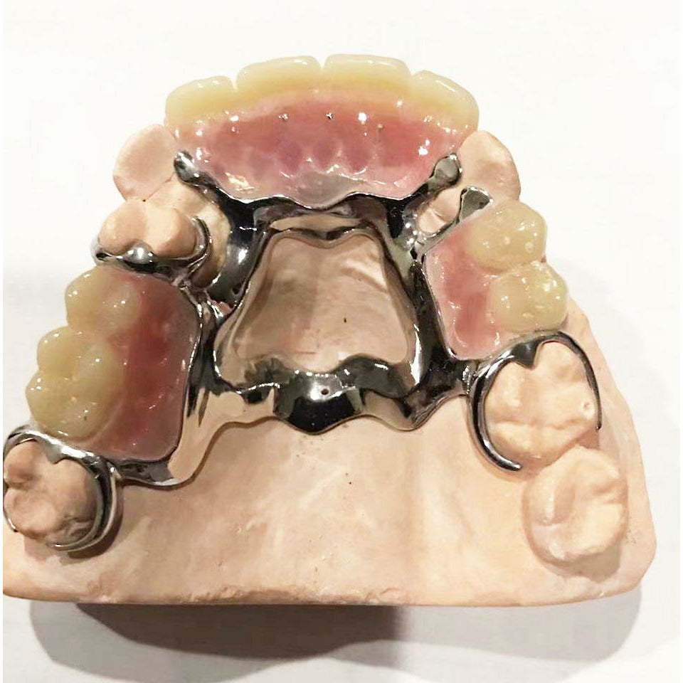 Metal Rame Maxillary Rpd Removable Partial Denture Design