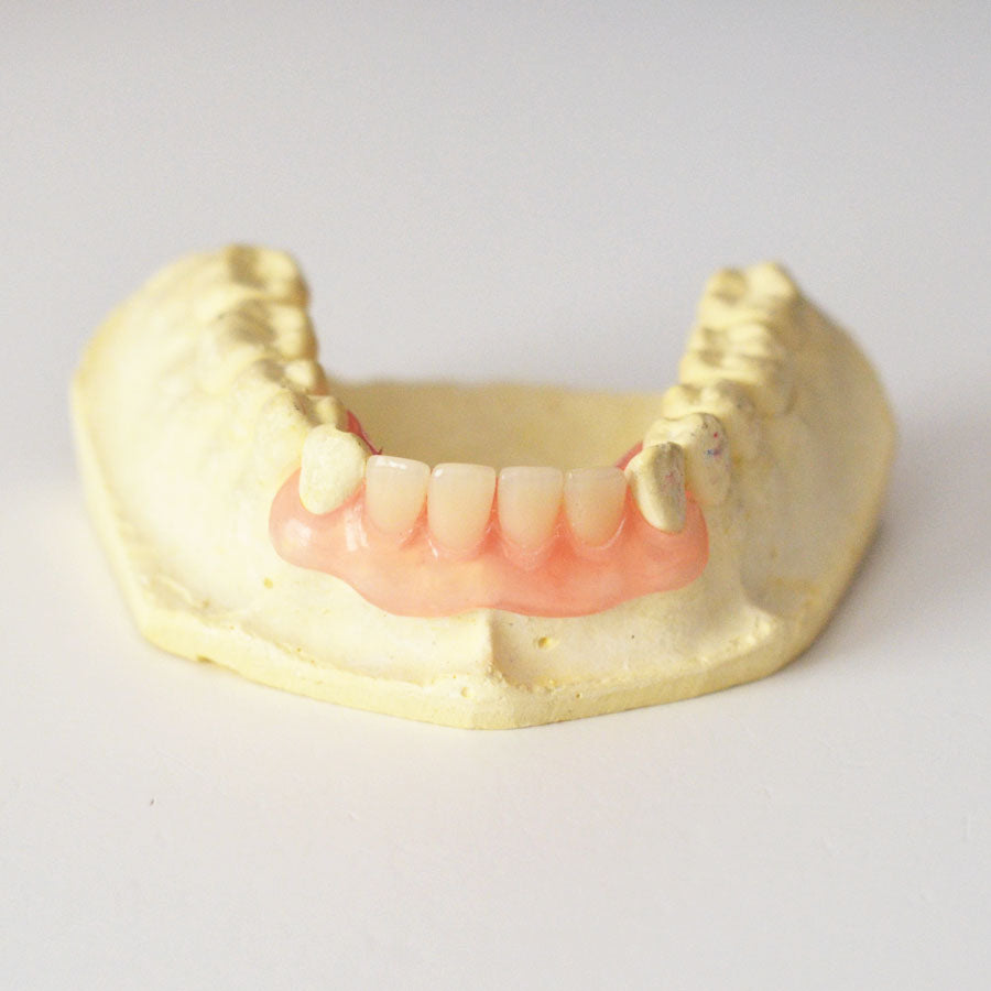 front teeth valplast partial denture