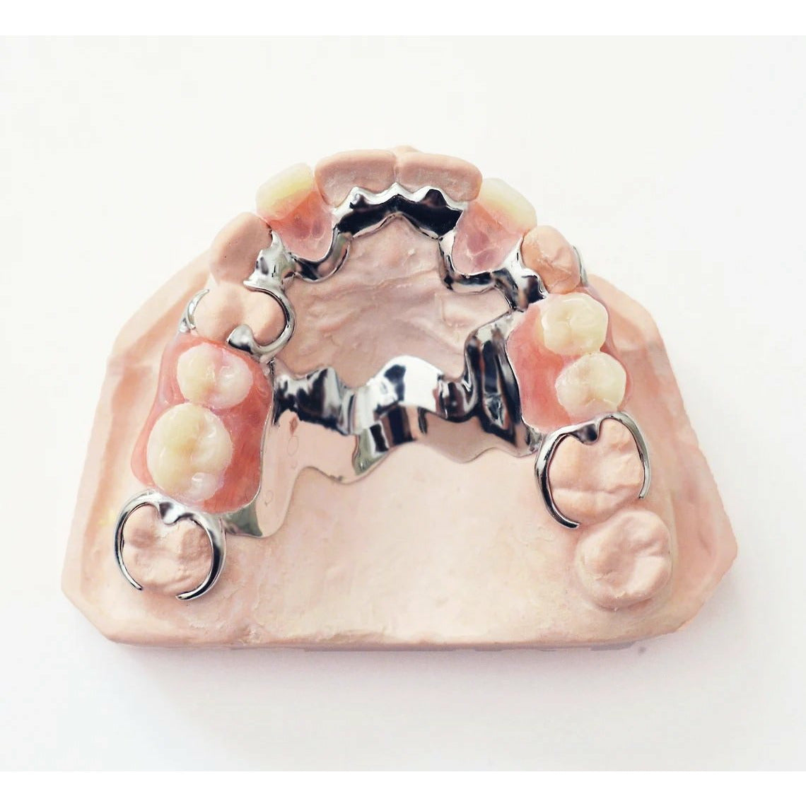 Buy Metal Partial Dentures Online