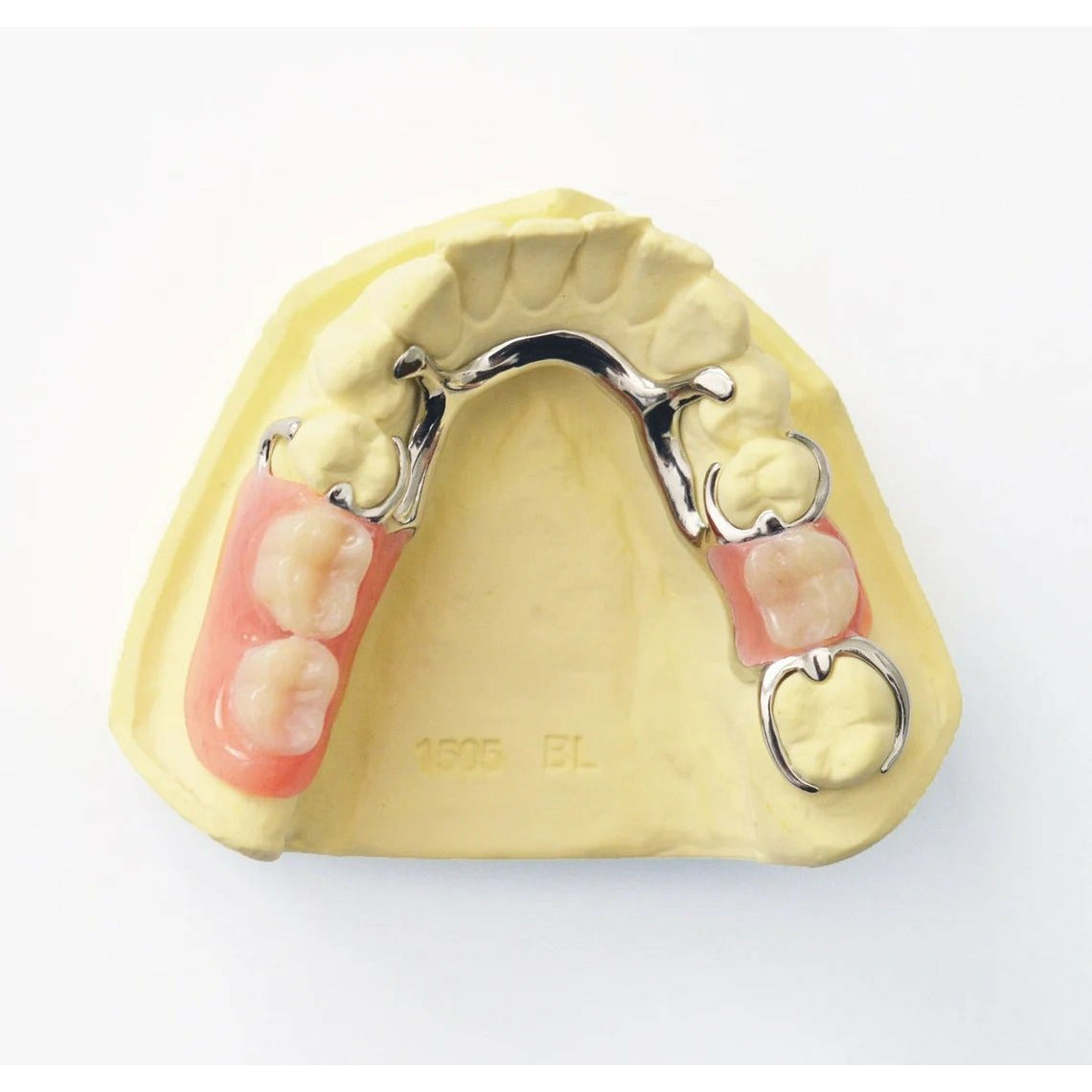 Removable Partial Denture For One Tooth